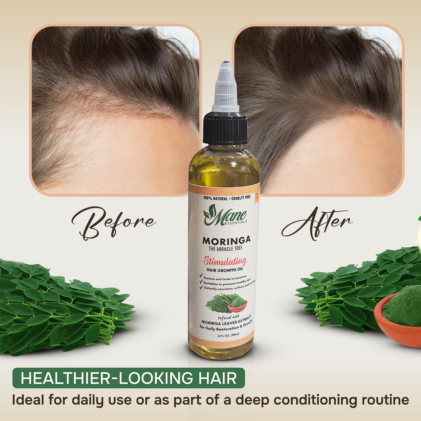MORINGA SCALP & HAIR STRENGTHENING OIL • GROWTH FORMULA • 4 FL OZ • FREE SATIN BONNET